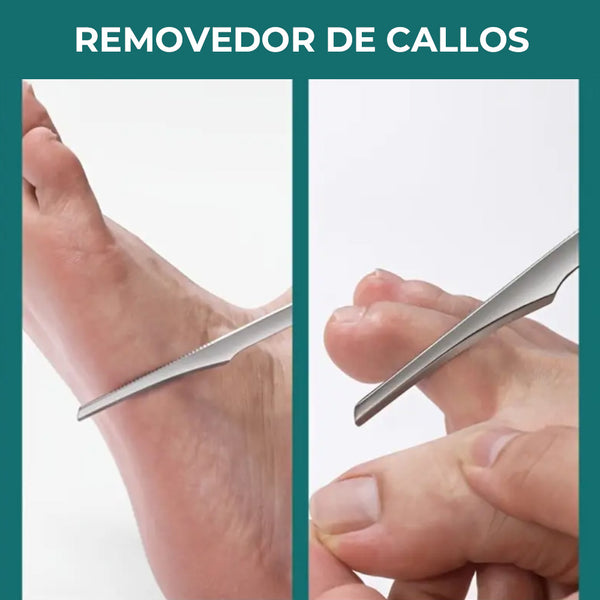 Removedor de callos