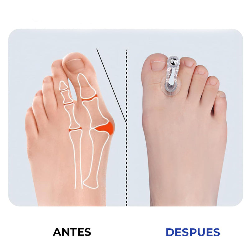 Separador de Dedo Magnético
